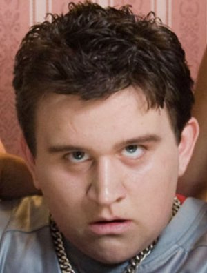 Harry Melling