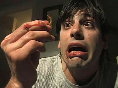 Bone Sickness